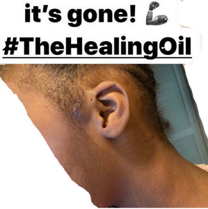 a. THE HEALING OIL